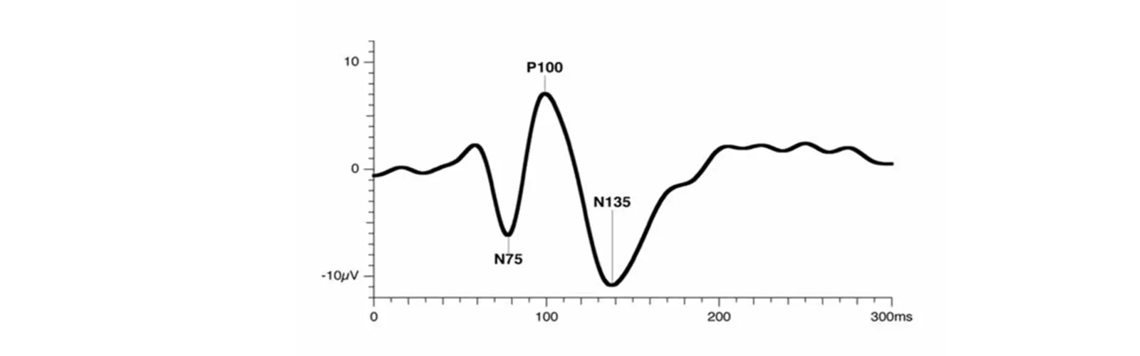 What Are The Functions Of Visual Evoked Potential (VEP) Test?